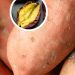 6 Well being Advantages Of Candy Potatoes