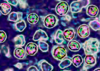 Measles outbreak in Texas balloons to 90 circumstances