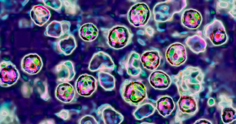 Measles outbreak in Texas balloons to 90 circumstances
