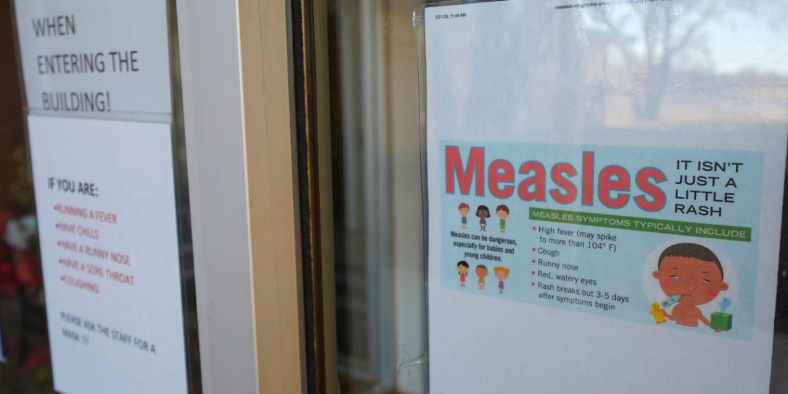US studies first measles loss of life since 2015 | Well being Information