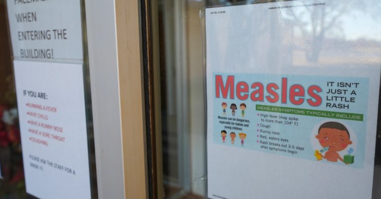 US studies first measles loss of life since 2015 | Well being Information