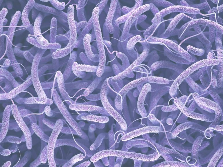 Cholera outbreak kills 58, sickens greater than 1,000 individuals over three days in Sudan, well being officers say