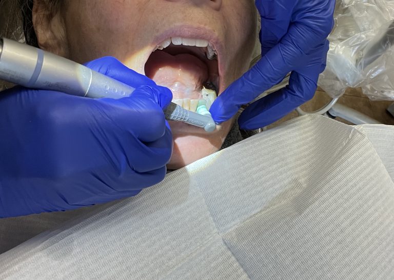 Lawmakers suggest larger Medicaid reimbursement charges for NC dentists