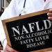 The Rising Burden of Fatty Liver in India: Way of life and Dietary Elements