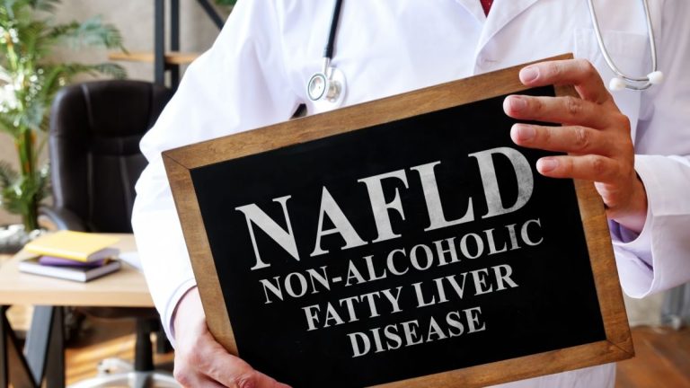 The Rising Burden of Fatty Liver in India: Way of life and Dietary Elements