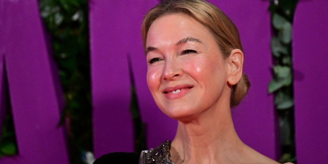 Renée Zellweger simply styled a sheer lace skirt in a surprisingly informal manner – and it’s excellent for spring