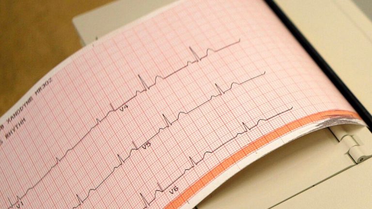 RRH hosts coronary heart well being screenings for State troopers