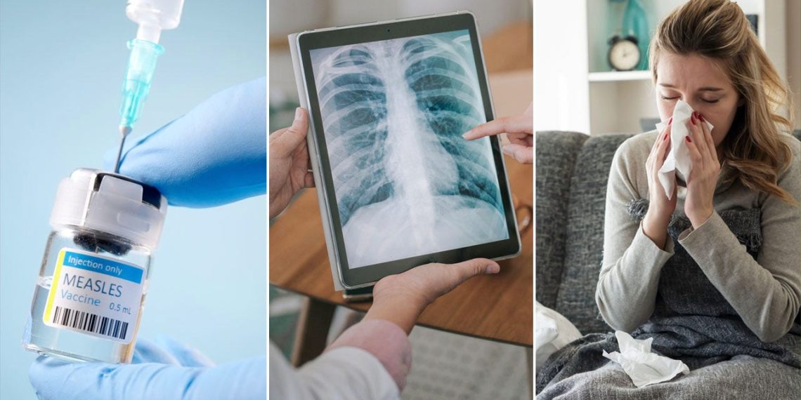 Flu circumstances by state and measles outbreak, plus regarding most cancers tendencies