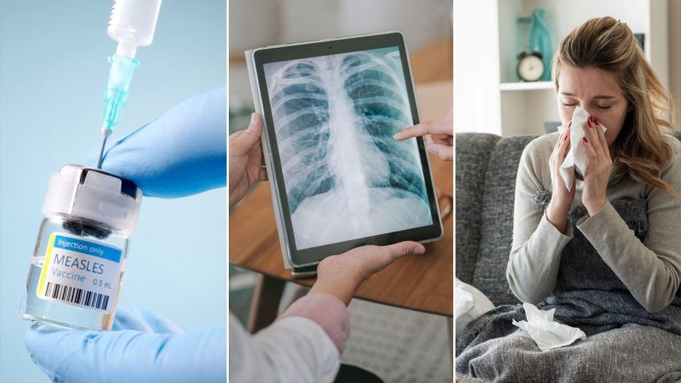 Flu circumstances by state and measles outbreak, plus regarding most cancers tendencies