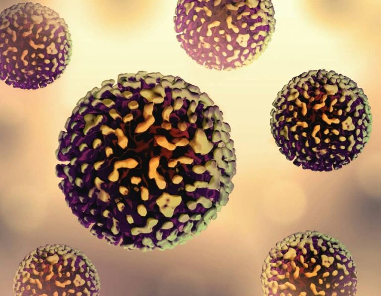Hepatitis A Publicity Alert at Calgary Restaurant