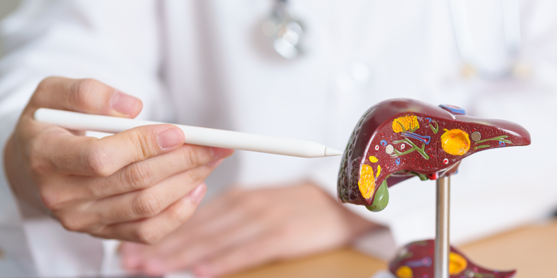 Fatty Liver: This frequent well being danger can improve the mortality price by 50%: Find out how to test