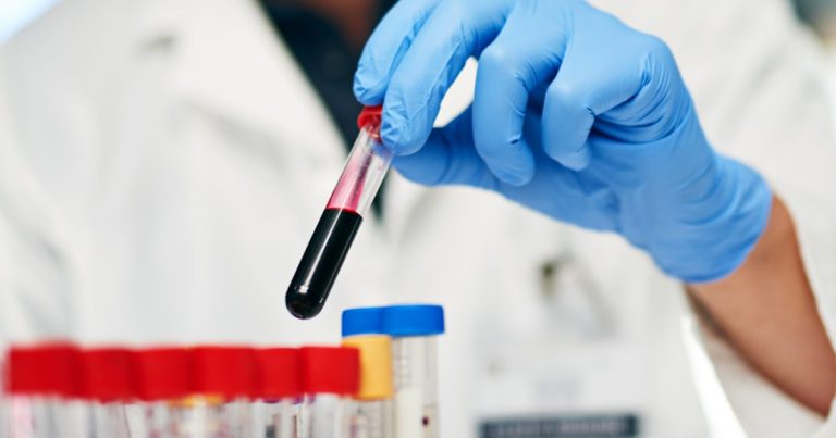 One dose of experimental drug practically wipes out stealthy ldl cholesterol in ‘exceptional’ trial