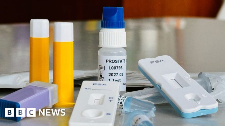 Speedy at-home PSA assessments spark issues