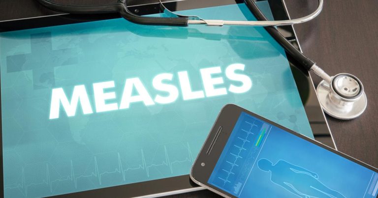 Tuolumne County well being officers examine 2 suspected measles instances | Information