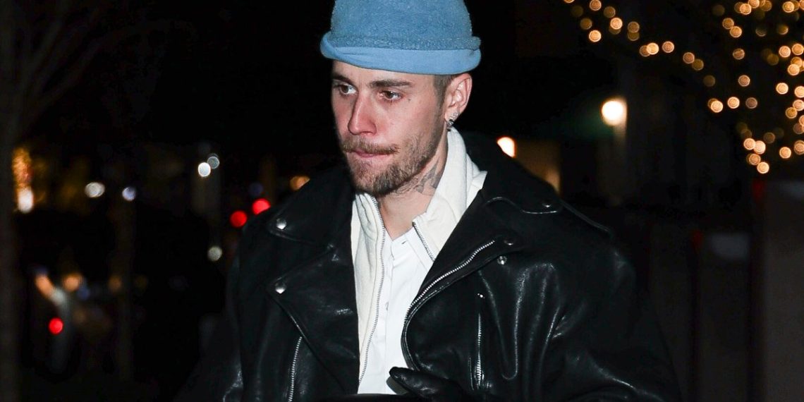 Justin Bieber engaged on ‘anger points’ whereas supporting Hailey Bieber – NBC Boston