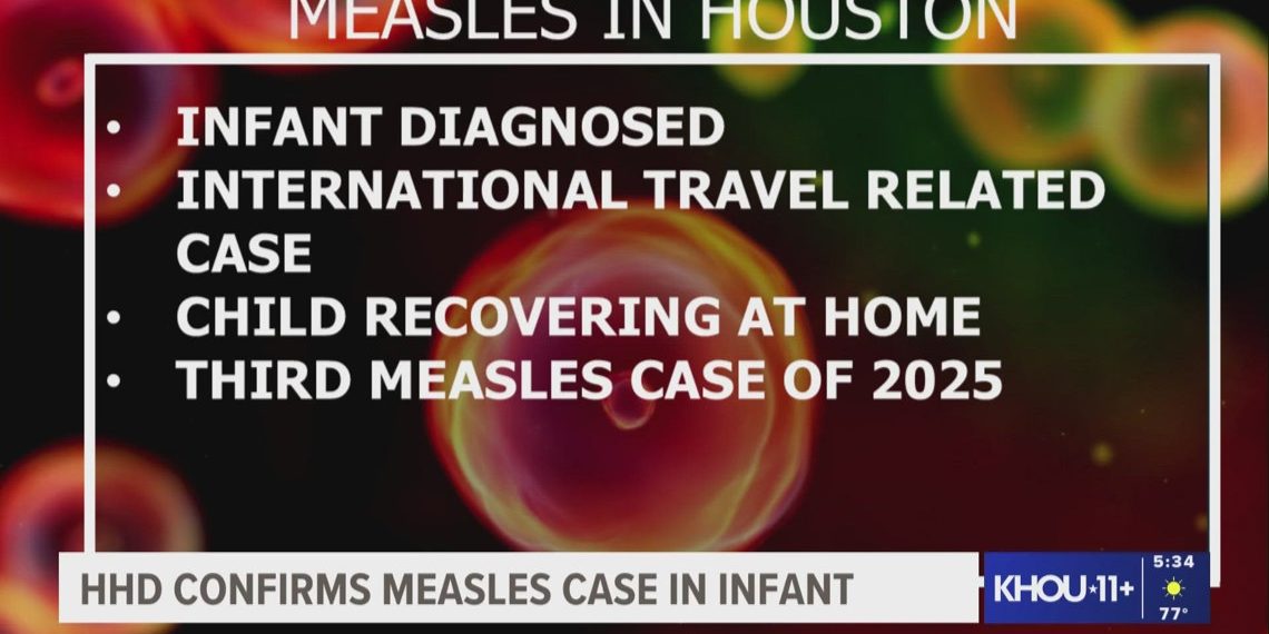 Houston Well being Division confirms little one has measles, recovering at dwelling