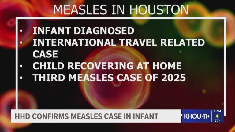 Houston Well being Division confirms little one has measles, recovering at dwelling