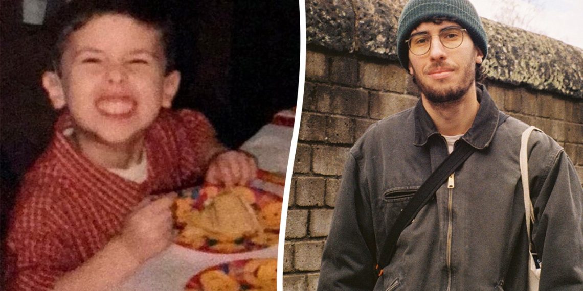 Man has meals allergy to 28 gadgets, describes his life as ‘more and more troublesome’