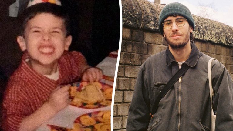 Man has meals allergy to 28 gadgets, describes his life as ‘more and more troublesome’