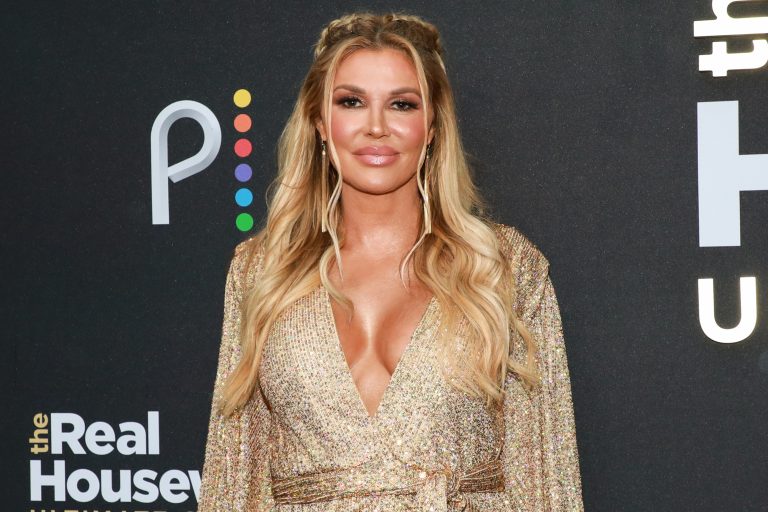 Bravo Star Will get Candid About Ongoing Facial Disfigurement