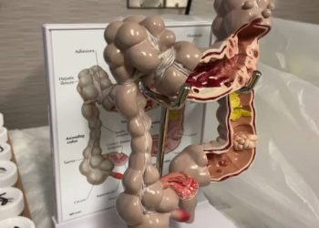 Well being professionals urge colon most cancers screenings