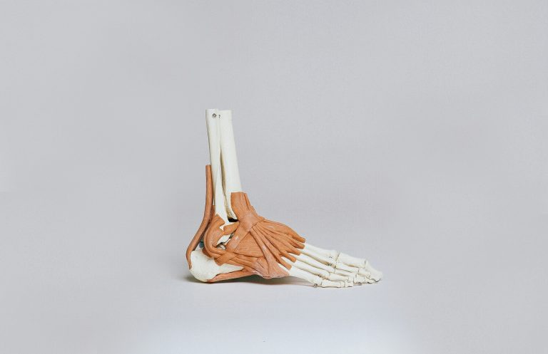 Sneakers that may warn you wounds? How sporting expertise turns foot care