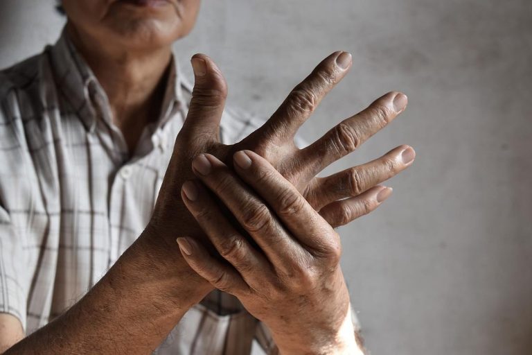 Arthritis and COPD Combo Will increase Dying Threat by 41%