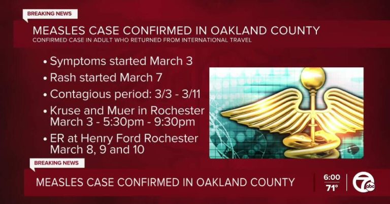 Oakland County Well being Division confirms measles case in grownup