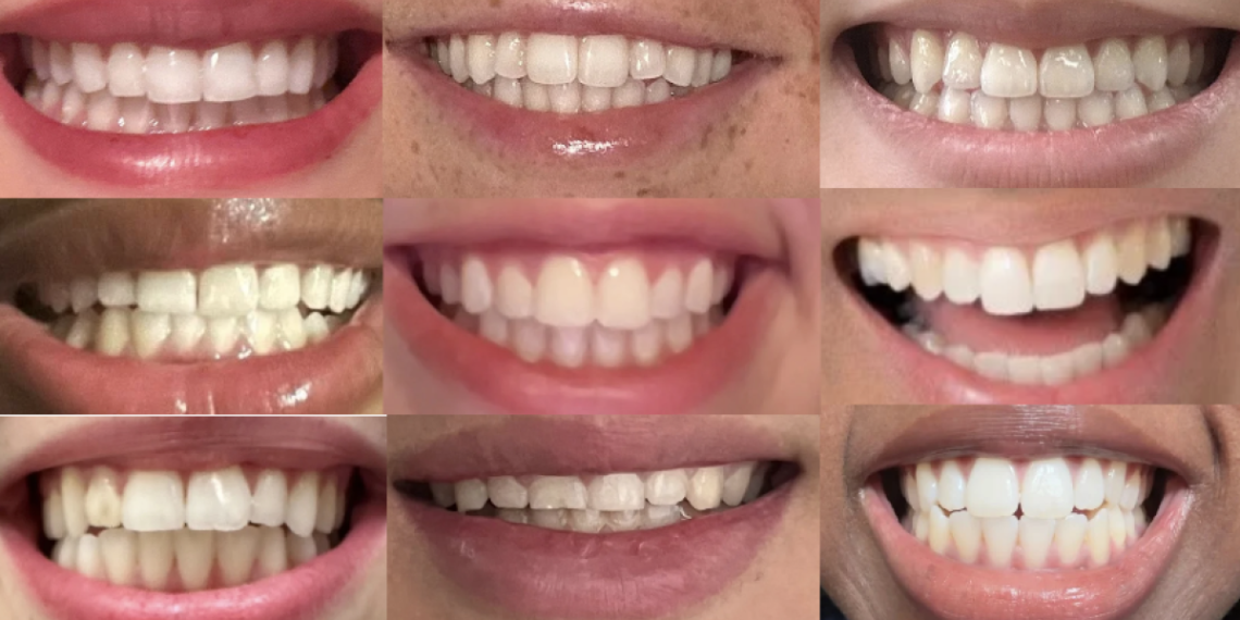 GOP state committeewoman’s push intensifies Alachua County’s fluoridation debate