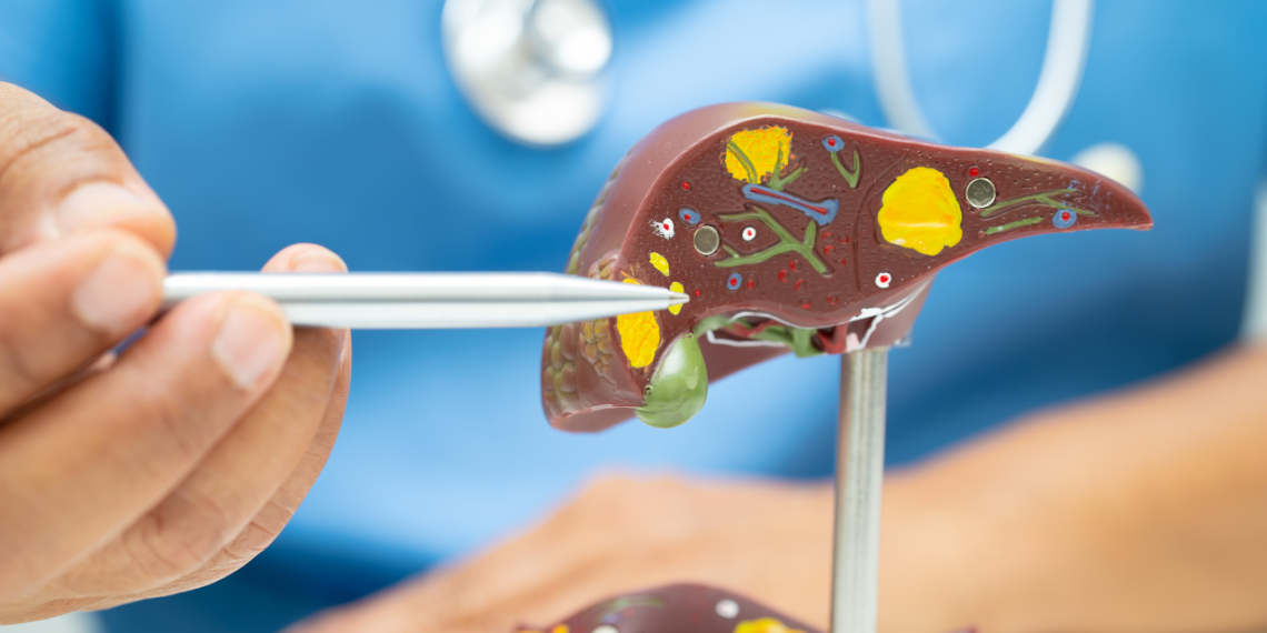 9 drinks that may naturally scale back liver fats in simply 2 weeks