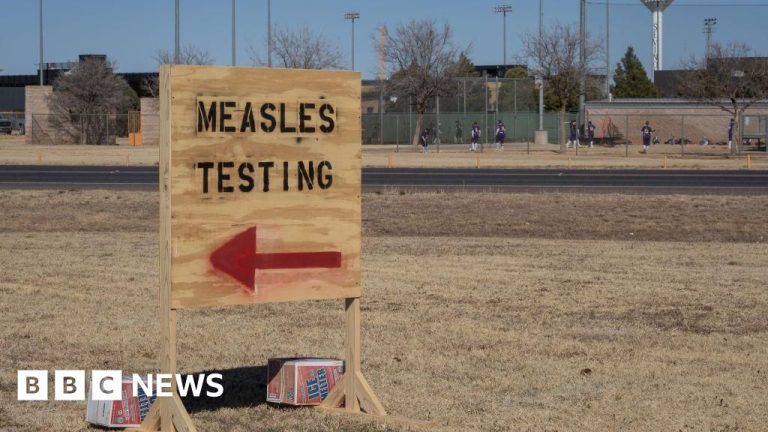 Second baby dies of measles as western Texas outbreak worsens