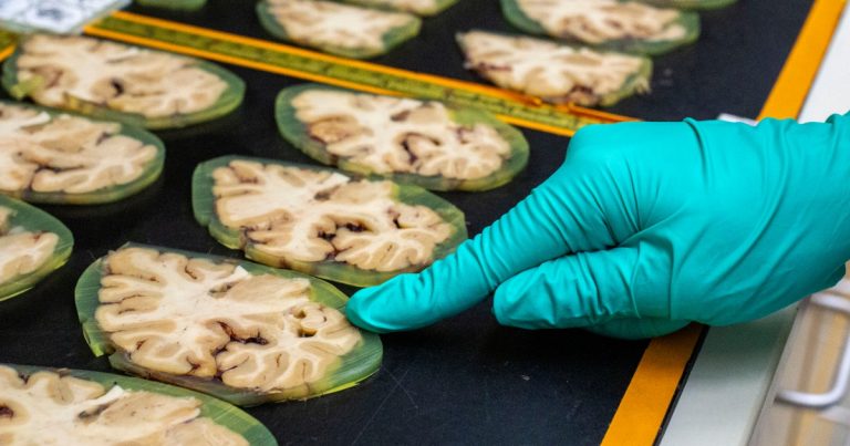 One of many nation’s main Alzheimer’s initiatives is in jeopardy