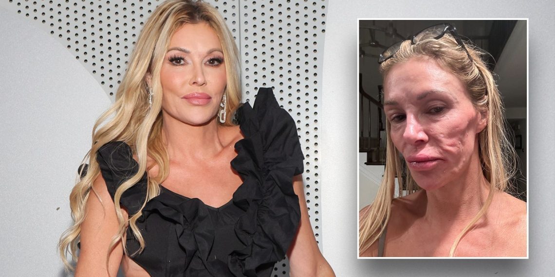 Brandi Glanville says celibacy is ‘not by alternative’ amid ongoing well being battle