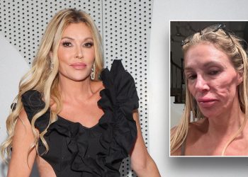 Brandi Glanville says celibacy is ‘not by alternative’ amid ongoing well being battle