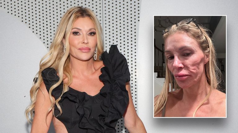 Brandi Glanville says celibacy is ‘not by alternative’ amid ongoing well being battle