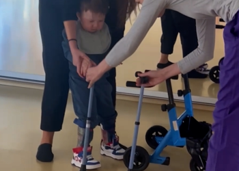 Boy with uncommon syndrome walks for the primary time – WFXG