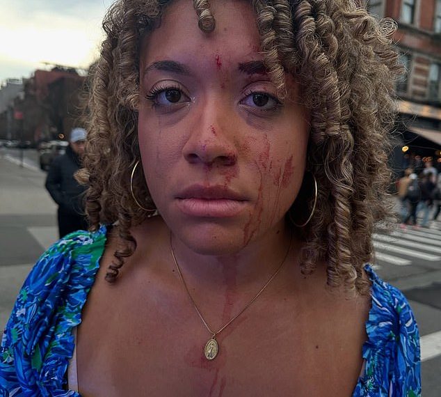 Professional-life activist left bloody after being punched within the face by enraged lady over abortion