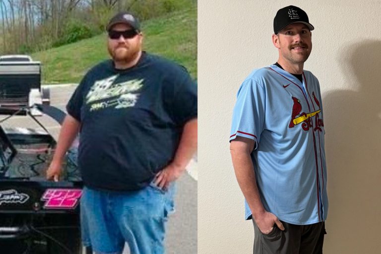Bariatric Surgical procedure Unlocks New Way of life, Renewed Well being For Travis
