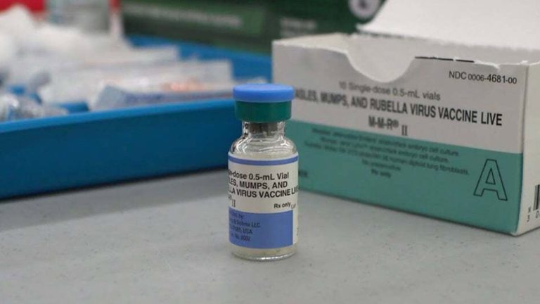 Why aren’t there any Arizona measles circumstances in 2025?