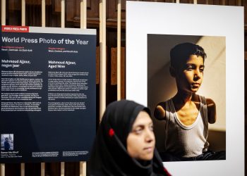 The world press image distinguishes the portrait of a Palestinian baby who misplaced each side as the image of the yr