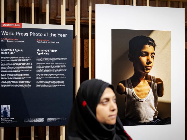 The world press image distinguishes the portrait of a Palestinian baby who misplaced each side as the image of the yr