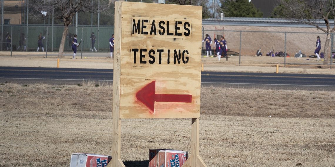 Second youngster with measles has died in Texas, officers say