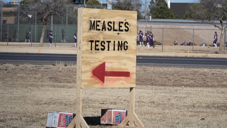 Second youngster with measles has died in Texas, officers say