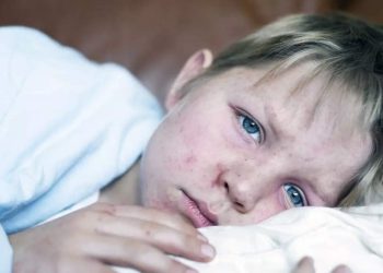 Extremely contagious measles outbreak sparks journey warning in US |