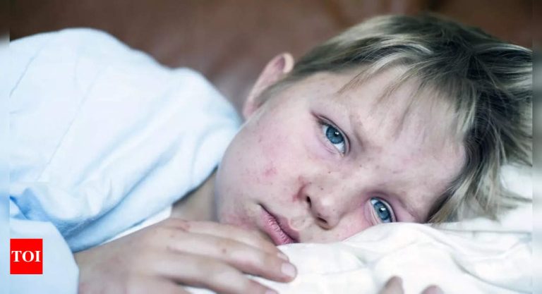 Extremely contagious measles outbreak sparks journey warning in US |