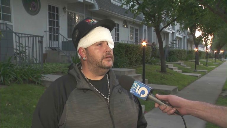 L.A. road meals vendor who serves free meals to homeless residents violently overwhelmed by attacker