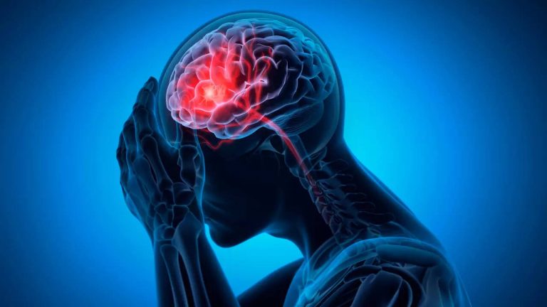 How do I do know if I’m having a stroke? three unmissable signs