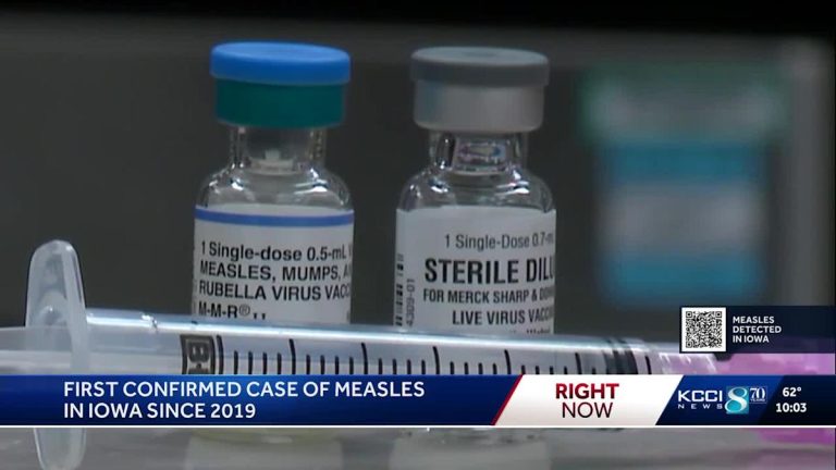 Iowa well being officers verify first case of measles since 2019 – Yahoo