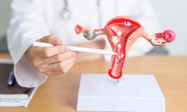 Bariatric Surgical procedure, Way of life Interventions Could Reduce Endometrial Most cancers Danger by 44 %: Research Finds