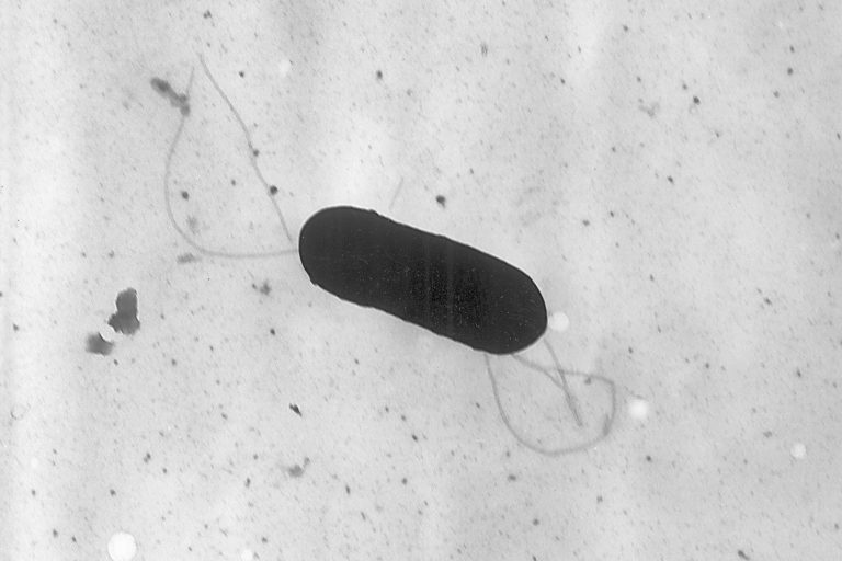 What to learn about meals poisoning sicknesses brought on by listeria